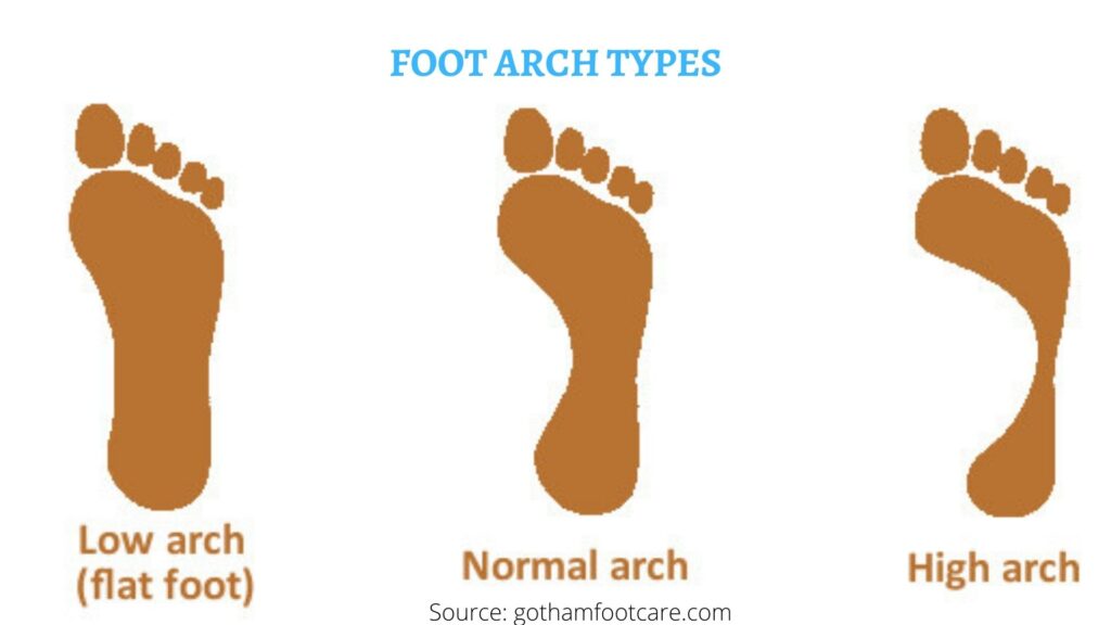 Foot Arch types